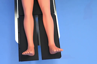 do explainer 3d medical animation 3d orthopedic surgery animation 3d modeling