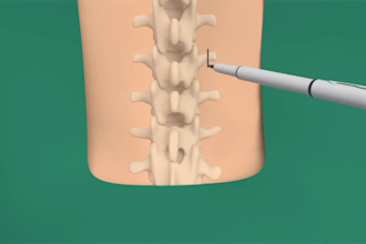 do 3d medical animation 3d surgery animation medical process