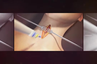 make 3d medical animation,3d surgery, anatomy, science animation,3d explainer