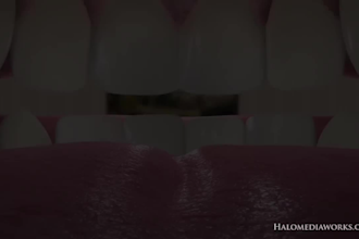 do 3d medical and anatomy animation 3d surgery with 3d procedure video