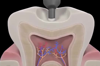 do 3d dental animation video 3d surgical explainer video 3d medical animation