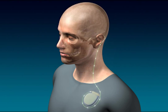 do nursing awareness animation, disease, patient animation, instructional video