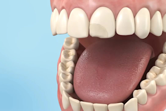 cgi 3d dental animation 3d surgery 3d dental model 3d teeth animation video