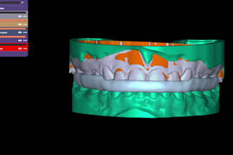design occlusal splints, night guards and retainers