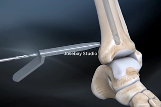 create 3d medical animation 3d orthopedic animation medical 3d surgery animation