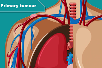 create medical or healthcare 2d animated explainer video