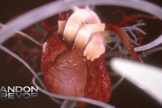 3d medical animation anatomy video 4d surgery scientific explainer illustration