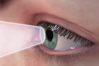 create 3d eye surgery animation, medical modeling, and anatomy videos