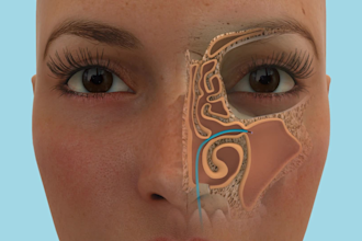 create high quality 3d medical animation, surgery animation