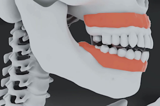 create 3d medical animation dental implant procedure biotech surgical animation