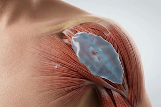 do ai 3d medical animation, health explainer video, medical product animation