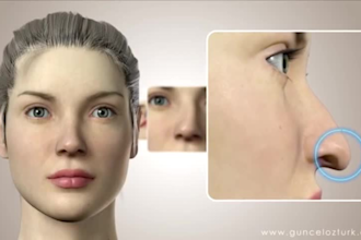 design 3d plastic surgery and cosmetic procedure animations