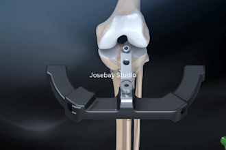 create orthopedic 3d medical animation, bone healthcare 3d surgery animation