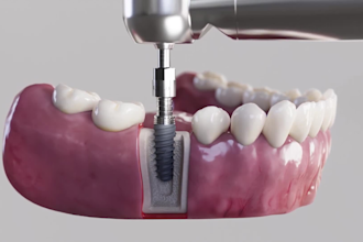 do 3d medical animation 3d dental explainer animation 3d orthodontic treatment