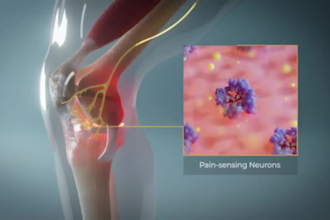 create 3d medical animation moa animation orthopedic animation knee animation