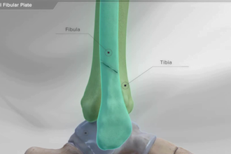 create 3d surgical and orthopedic medical animation