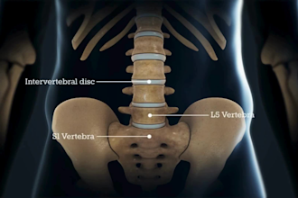 create 3d medical animation human skeletal anatomy spine surgery orthopedic