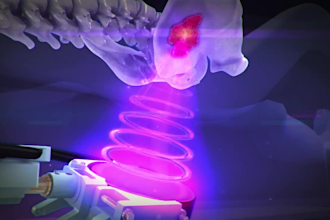 create 3d medical  explainer video, 3d moa surgery animation, 3d modeling