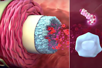 do 3d surgery animation, 3d medical animation, medical animation, 3d medical
