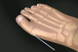do 3d medical animation for a product or procedure
