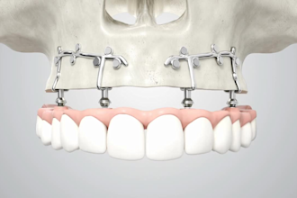 create professional 3d medical animation and surgical videos