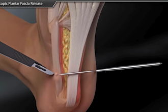 do full hd 3d medical animation pathophysiology surgical procedure product video