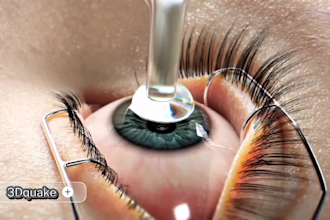 do realistic 3d medical animation 3d surgical 3d animation video anatomy model