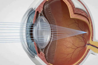 create 3d ai medical animation, medical education, patient education, anatomy