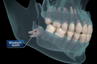 do 3d dental animation 3d cgi animation healthcare explainer pharmaceutical vide
