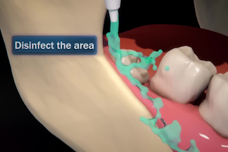 do 3d dental animation orthodontic animation 3d medical device explainer video