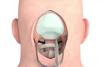 create 3d medical animation for surgical procedure with high quality rendering