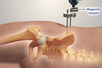 do 3d medical animation for surgical procedure, hip replacement spine orthopedic