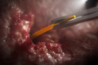 create 3d medical animation and scientific 3d product animation