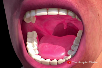 do 3d dental implant 3d teeth model orthodontic treatment medical animation