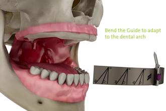 create high quality 3d medical animation, dental implant surgery video