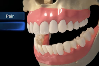 do 3d medical animation 3d dental animation scientific moa pharmaceutical video