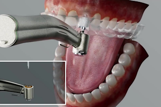 3d medical animation video 3d medical explainer 3d medical anatomy animation