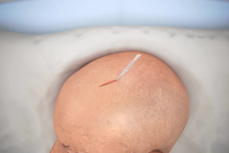 create realistic 3d medical animations 3d neurosurgery brain anatomy animation