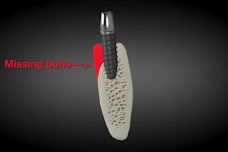 do 3d medical animation, dental implant, surgical and healthcare explainer video