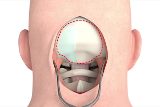 do 3d medical animation for surgical procedure with high quality rendering