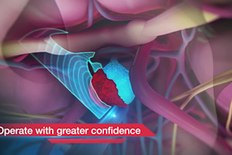 create 3d medical animation video 3d medical video  medical surgery 3d animation