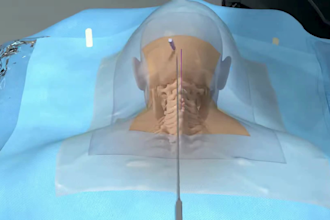 create realistic 3d cosmetic surgery and aesthetic procedure animations