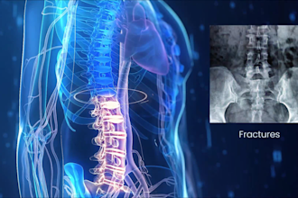 do medical animation, 3d medical animation, 3d animation