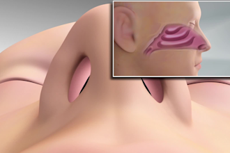 create 3d medical animation, surgical animation, rhinoplasty, anatomy animation