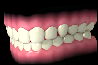 create realistic cosmetic dentistry explainer video on smile makeover treatments