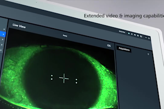 create 3d medical animation, medical explainer anatomy and surgical video