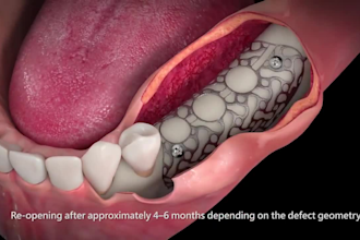 do 3d dental animation, 3d medical animation, dental implant and 3d animation