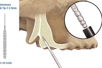 do 3d medical animation surgical procedure video orthopedic surgery explainer