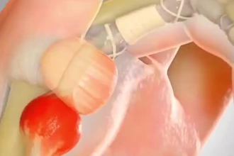 create 3d anatomy animation human anatomy animation medical explainer animation