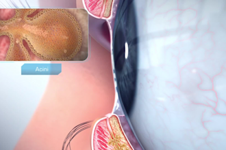 2d 3d medical animation, 3d medical product explainer, anatomy medical device